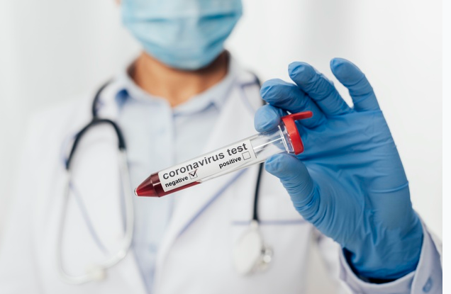 Coronavirus Test sample